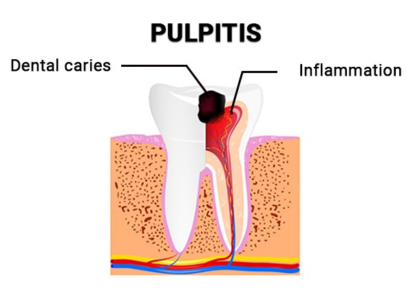 Emergency Dental Care
