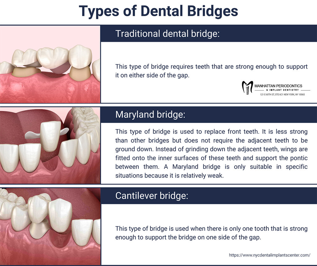 NYC Dental Implants Center