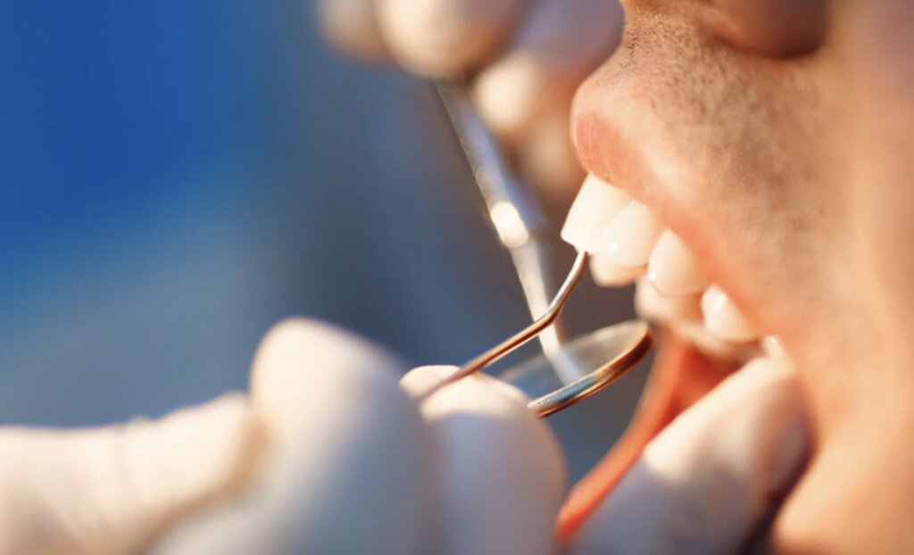 Delayed-Onset Dental Trauma After a Car Accident: Signs and Risks