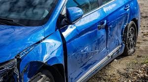 Understanding Dental Injuries Due to Car Accidents