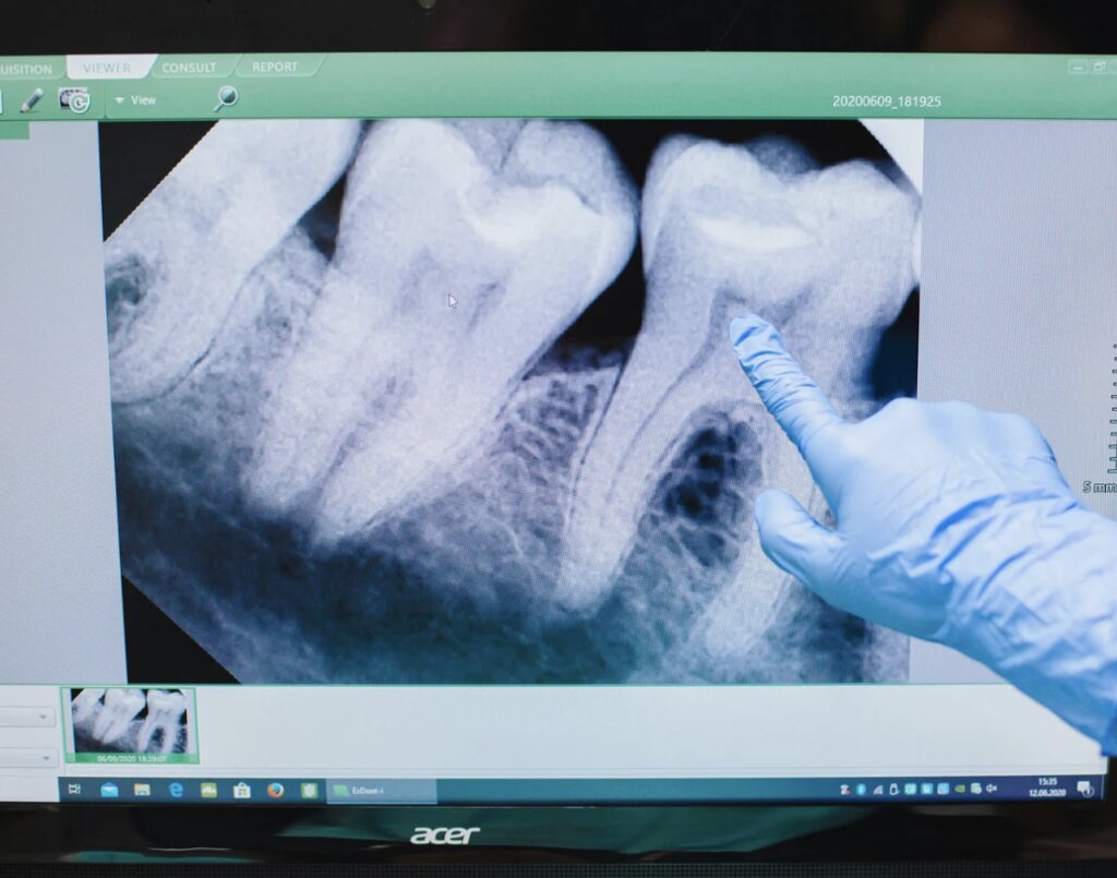 Why Dentist Testimony Is Important in Motorcycle Accident Injury Cases