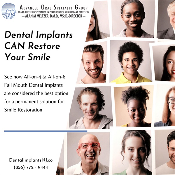 What Are Dental Implants? What Is All-On-4? Can I Restore My Smile?