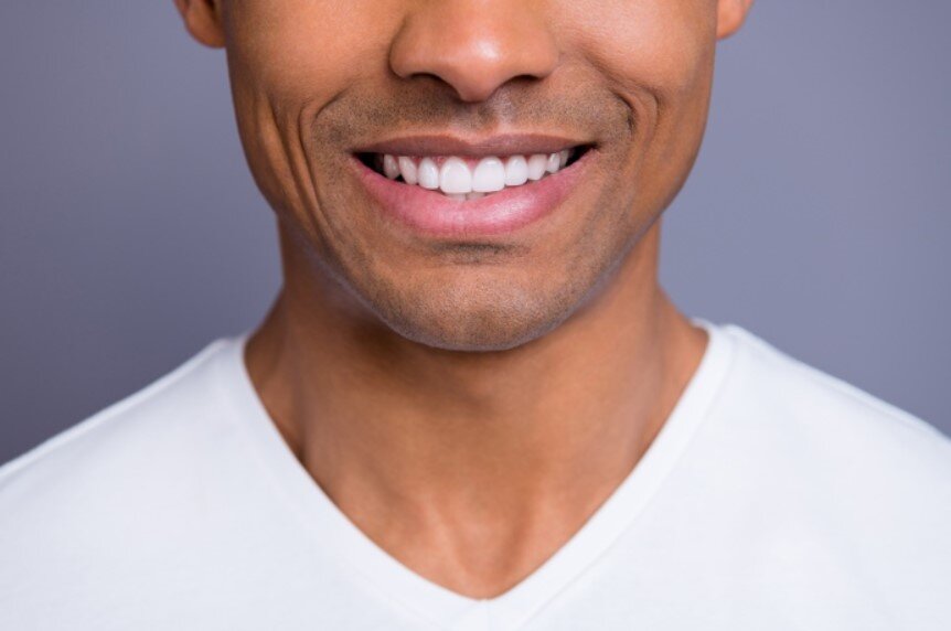 How Long Do Teeth Veneers Last? Maintenance Tips for Longevity