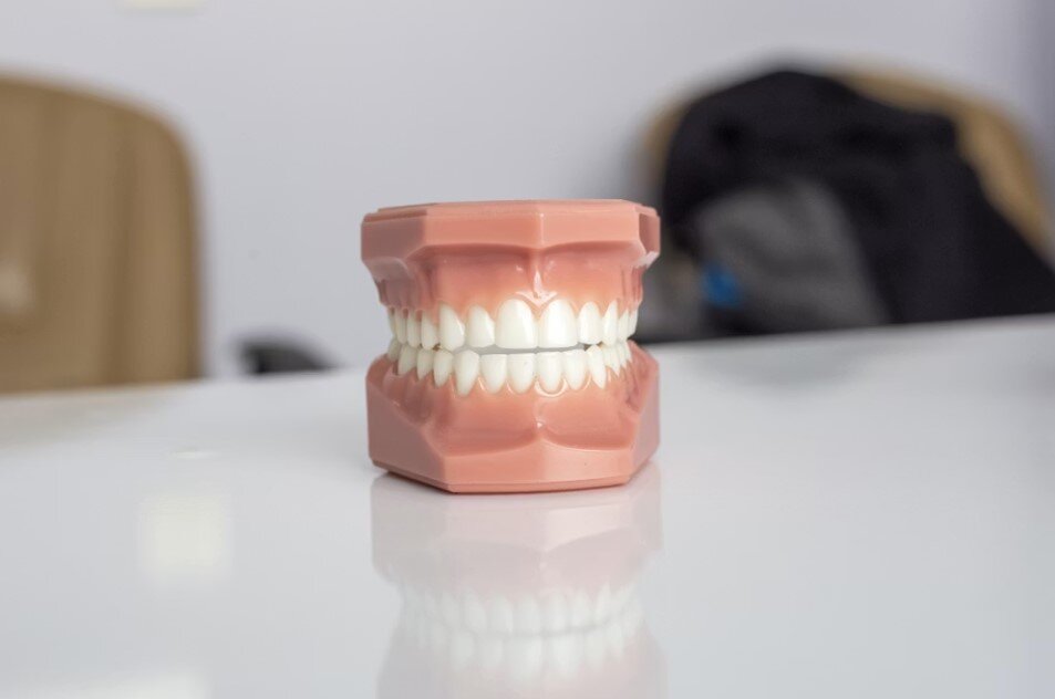 Why More Patients Are Choosing Implant-Supported Restorations Over Traditional Dentures
