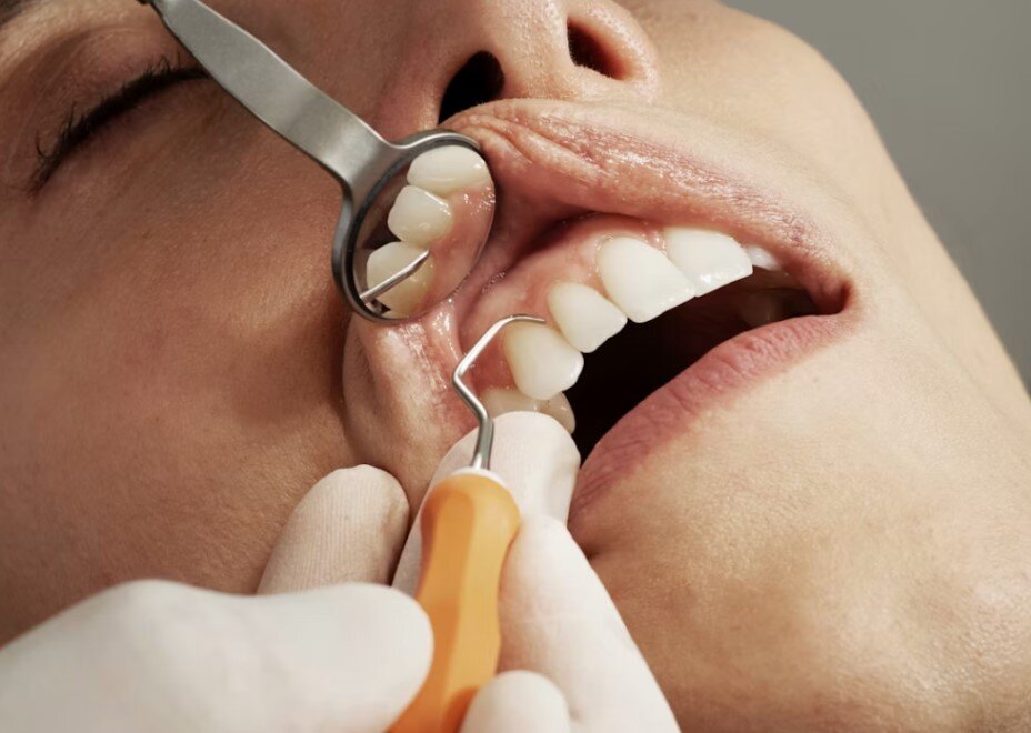The Growing Importance of Implant Maintenance in Modern Dental Practices