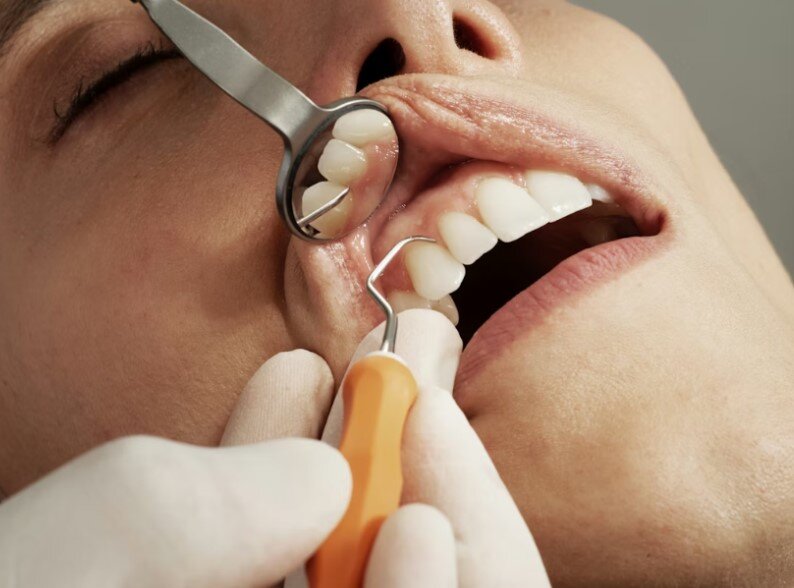 Immediate vs Delayed Dental Implants: What Clinicians Need to Consider in 2026