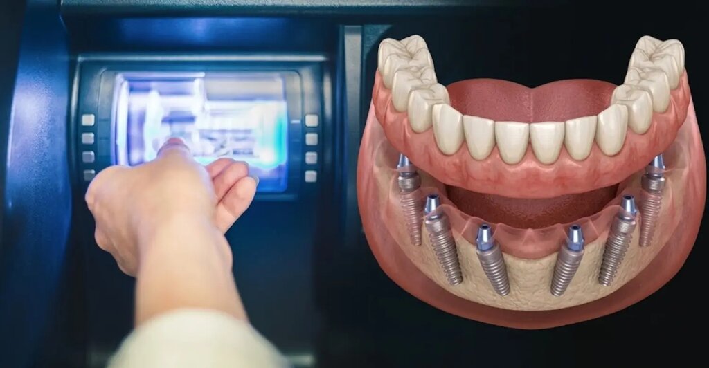 Dental Implants Turkey: Why More Patients Are Choosing Turkey for Advanced Dental Care