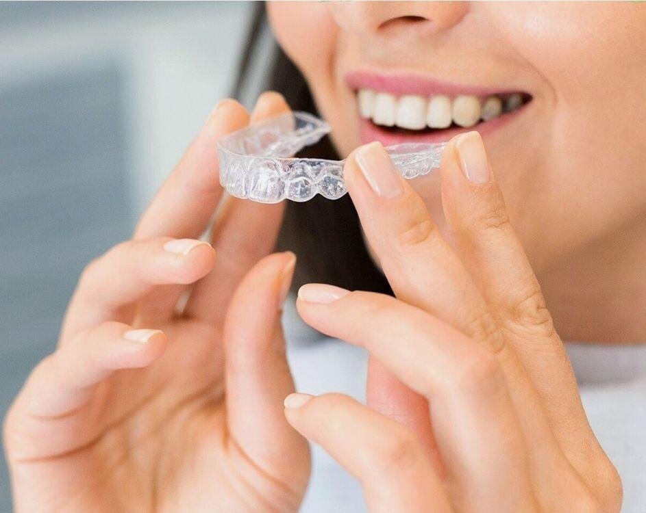 What to Do If Your Clear Aligners Start to Smell