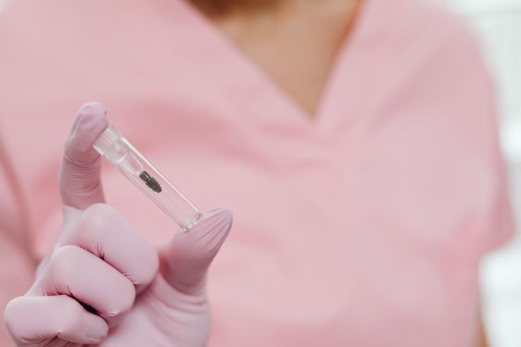 Dental Implant Recovery Tips During the First Week of Healing