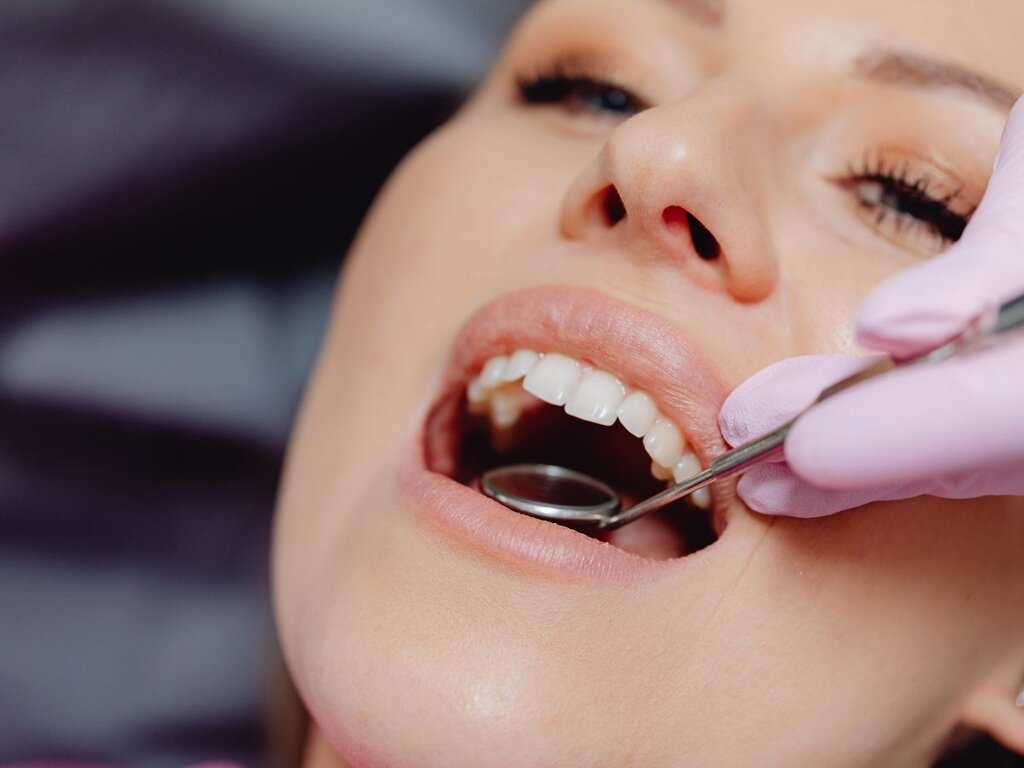 What Is Full Mouth Reconstruction and Who Needs It?A Real Dentist’s Perspective