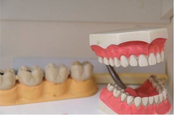 Weighing the Best Tooth Replacement Options