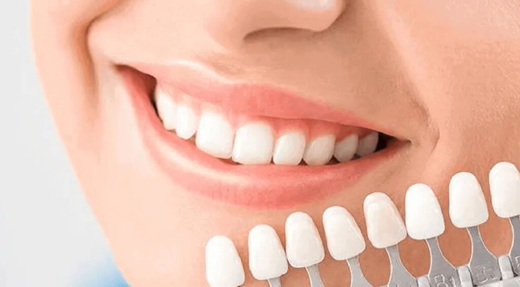 Choosing a Dentist in Long Beach: Understanding Your Options for Repairing and Improving Your Smile
