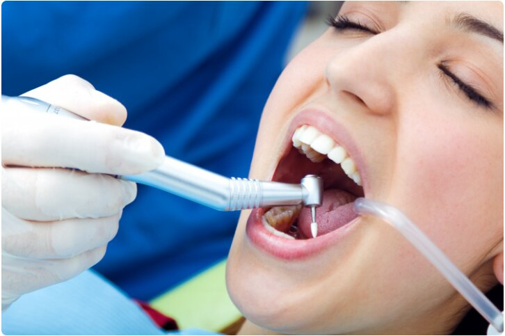 How Long Does a Root Canal Take? What Actually Determines the Appointment Time