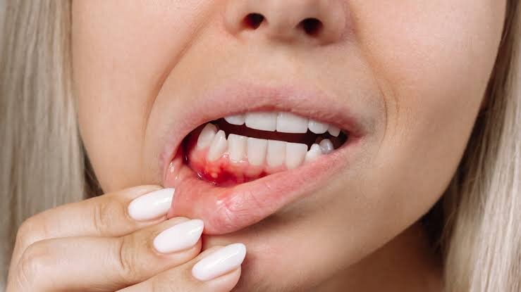 Early Warning Signs Your Gums Need Some Serious Attention 